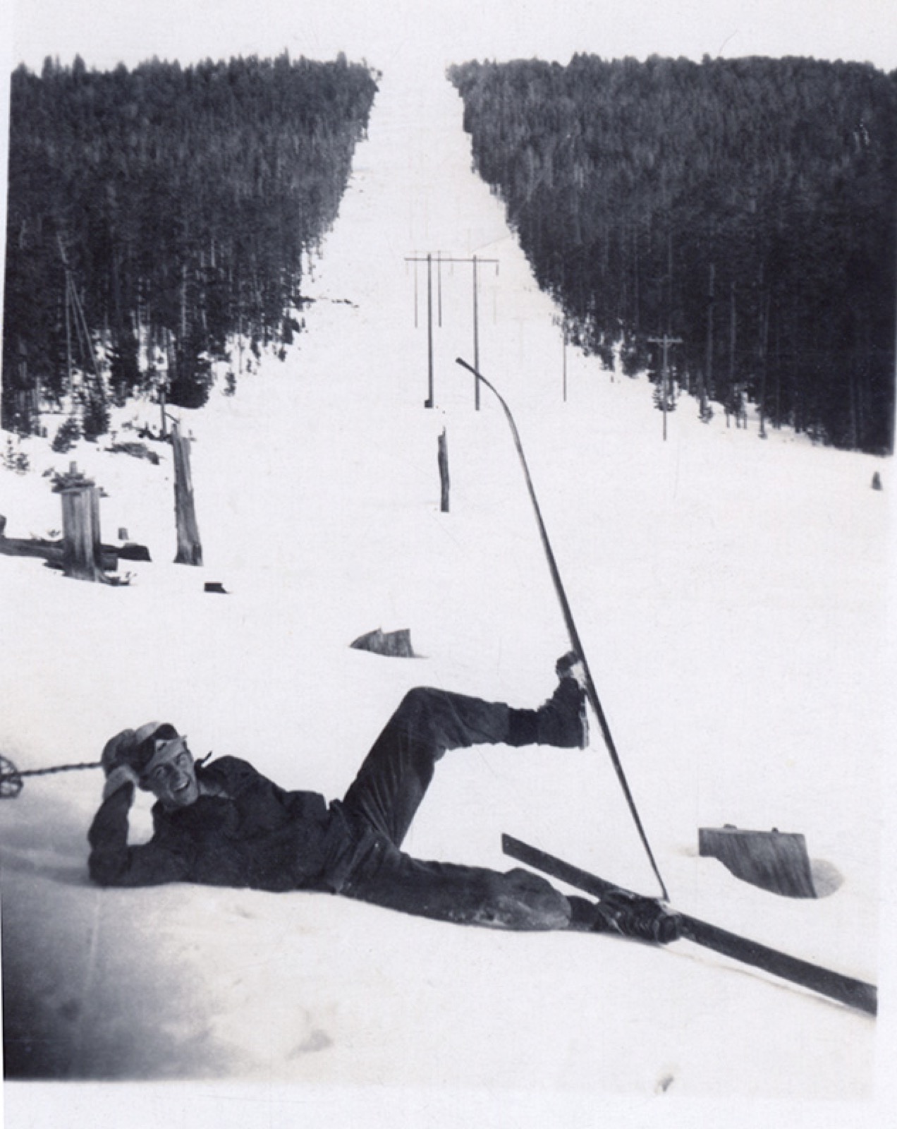 A skier reclining in the foreground; behind, a newly cut run with a line of tow towers up the middle and fresh stumps in the snow
